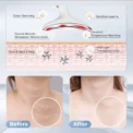 Face Massager EMS Facial Microcurrent Neck Face Lifting Massager Anti-aging Facial Massage Anti Wrinkle Skin Tightening Device - Image 5