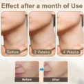 Face Massager EMS Facial Microcurrent Neck Face Lifting Massager Anti-aging Facial Massage Anti Wrinkle Skin Tightening Device - Image 6