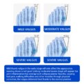 Bunion Corrector Toe Separator Foot Hallux Valgus Braces Orthotics Feet Bone Adjuster Correction Toe Straightener Foot Care Tool: 3 - 5 Days Free Delivery Only UK - Image 5