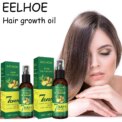 EELHOE Ginger Hair Care Spray Strengthening Hair Root Nourishing Scalp Promote Hair Growth Repair : 3 - 5 Days Free Delivery Only UKHair Care Oil Spray: 3 - 5 Days Free Delivery Only UK