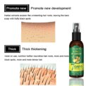 EELHOE Ginger Hair Care Spray Strengthening Hair Root Nourishing Scalp Promote Hair Growth Repair : 3 - 5 Days Free Delivery Only UKHair Care Oil Spray: 3 - 5 Days Free Delivery Only UK - Image 3