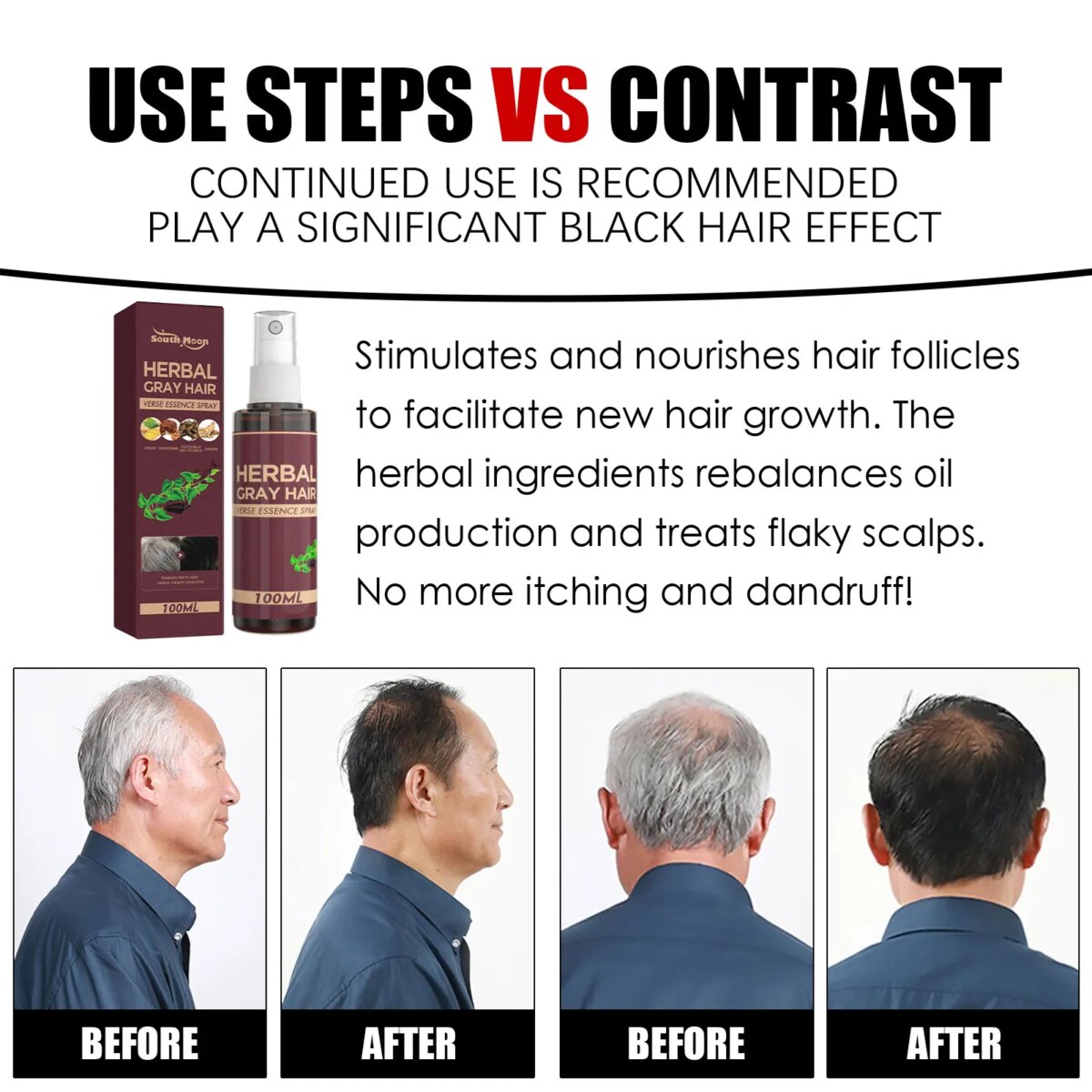 South Moon 100ml Hair Darkening Herbal Spray Polygonum Multiflorum Whiten To Black Natural Oil Control Anti Grey Hair Spray: 3 - 5 Days Free Delivery Only UK - Image 4